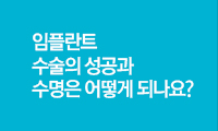 임플란트 수술의 성공과 수명은 어떻게 되나요?